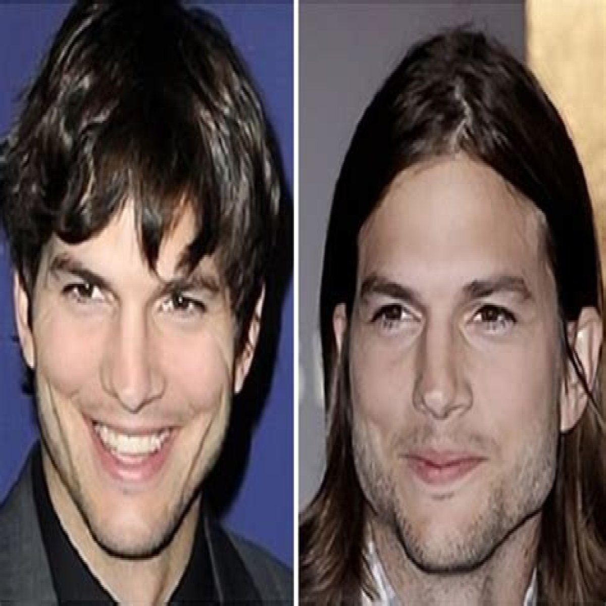Ashton Kutcher Nose Job Plastic Surgery Before and After