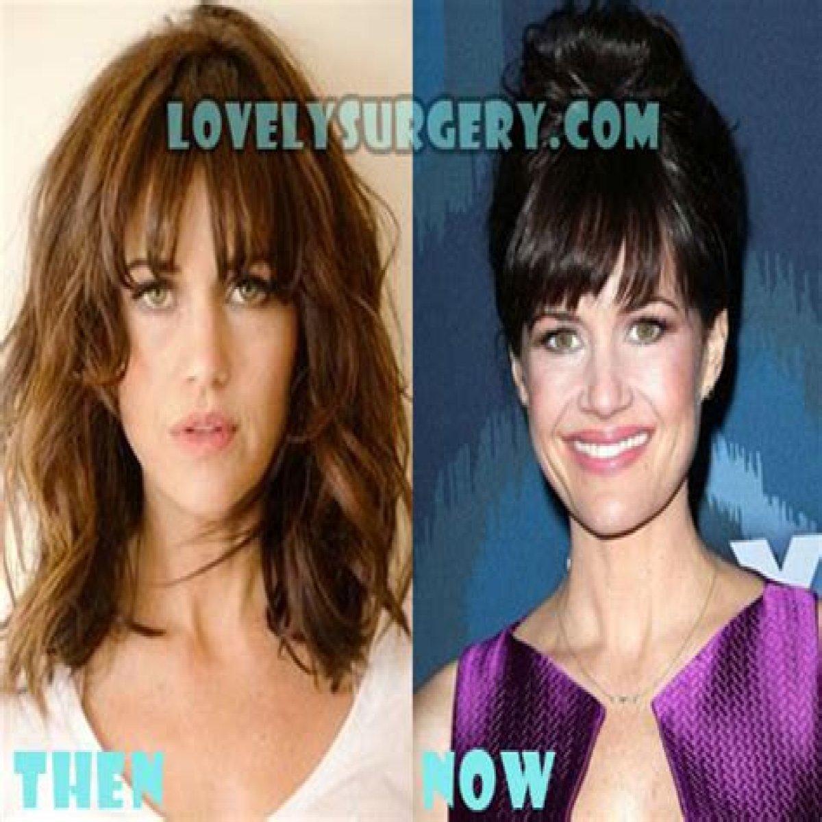 Carla Gugino Plastic Surgery Before and After