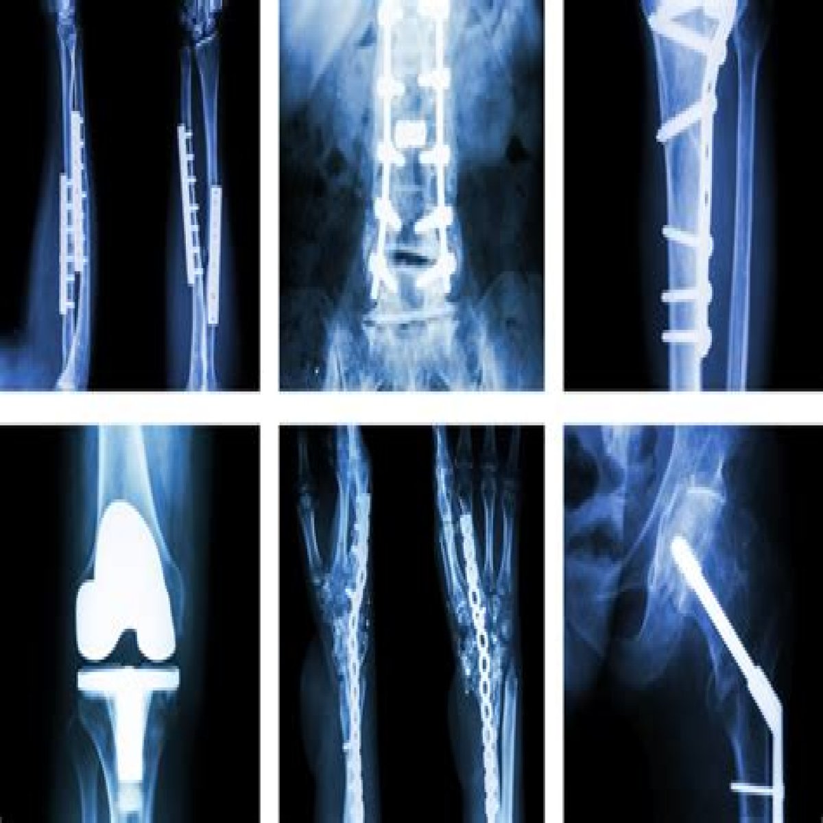 Do Orthopedic Surgeons Have Their Own Ray Machines?