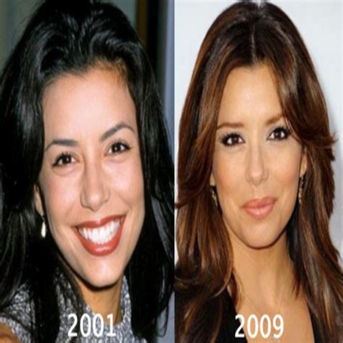 Eva Longoria Breast Augmentation Plastic Surgery Before and After