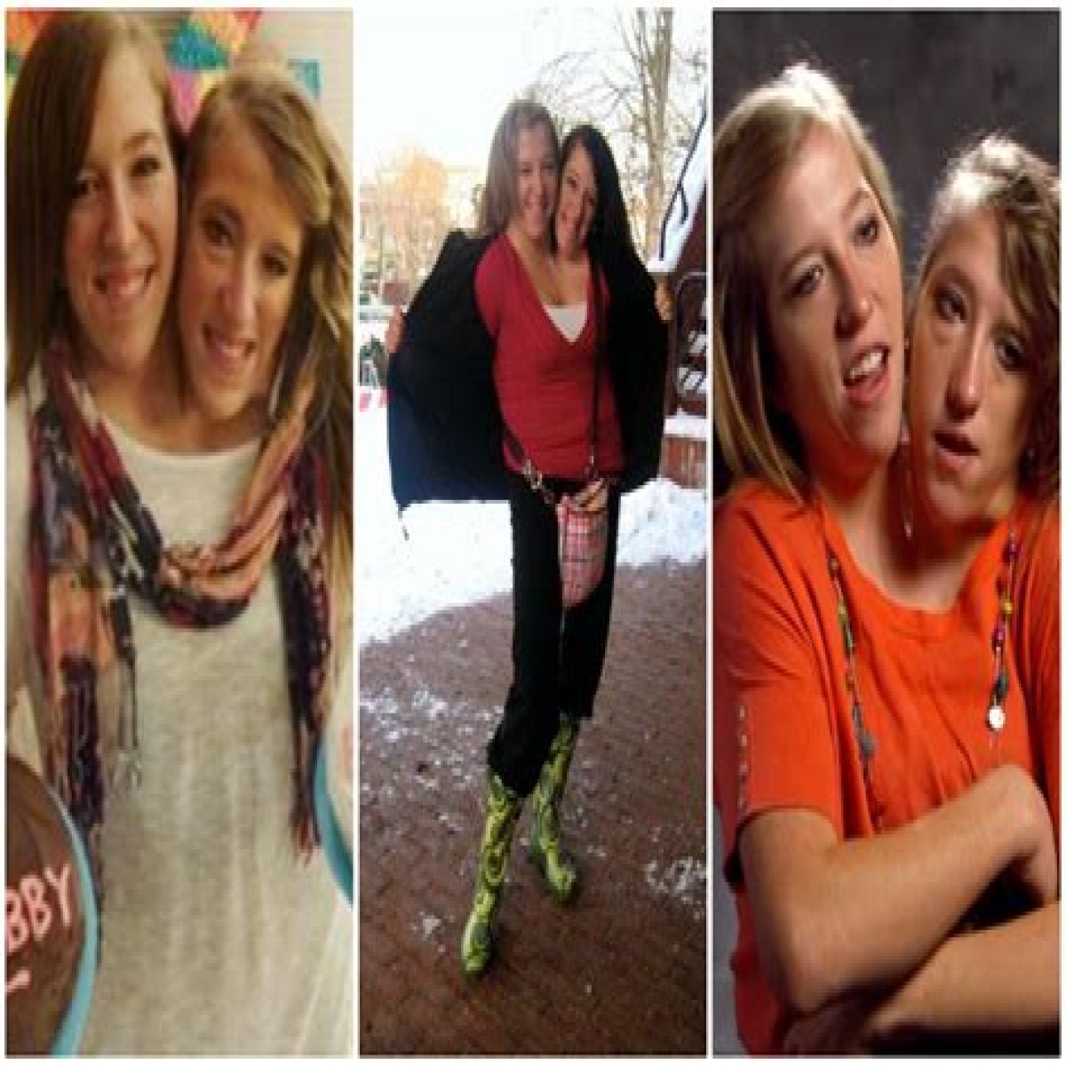 Exploring The Lives Of Abby And Brittany Hensel: Did They Die?