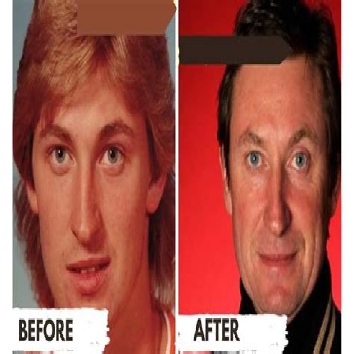 Is Wayne Gretzky Plastic Surgery true or rumor?