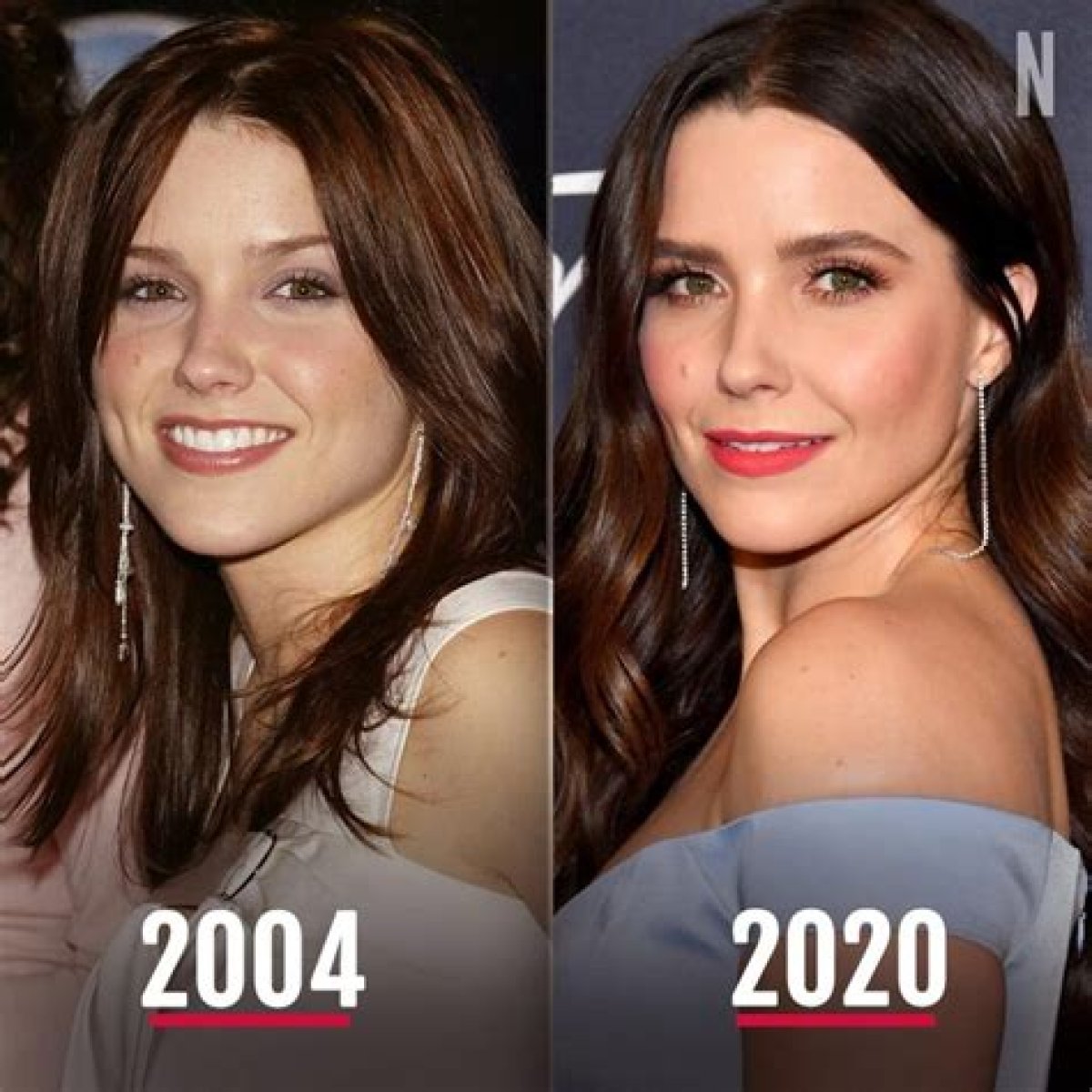 Sophia Bush Plastic Surgery Before and After