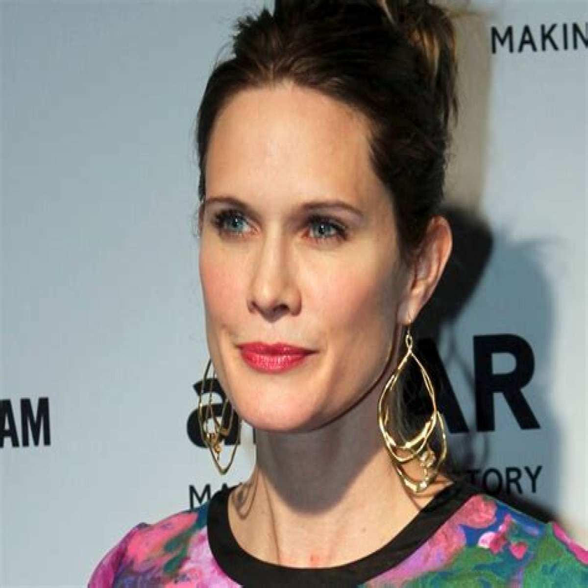 Stephanie March details her horrific journey through breast augmentation