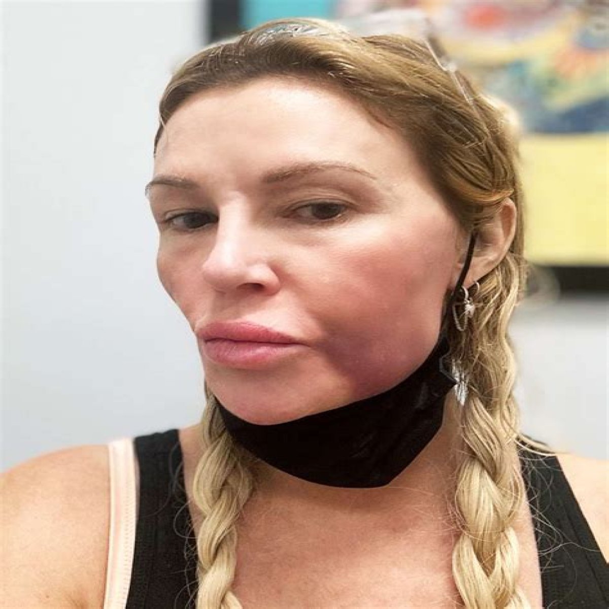 What Happened To Brandi Glanville’s Face? Has She Done Plastic Surgery